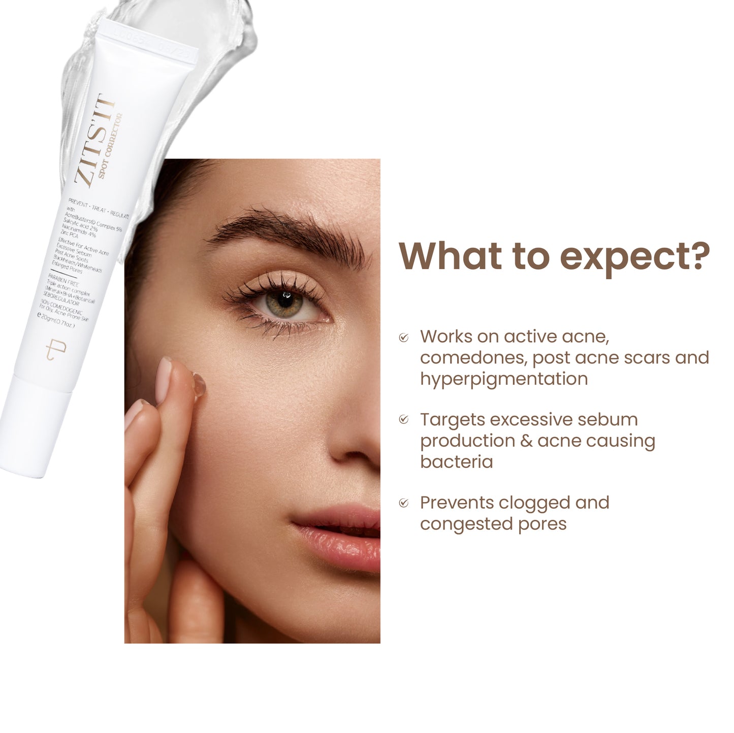 Zitsit Spot Corrector for Active Acne | Acne Scars | Salicylic | Niacinamide | Zinc - Acne Prone & Active Acne